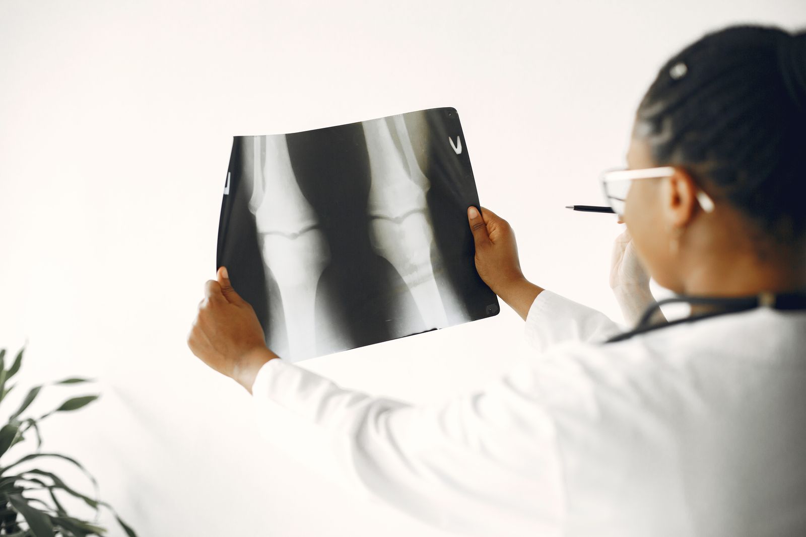 Médecin examinant une radiographie du genou lors d'une expertise médicale après un accident